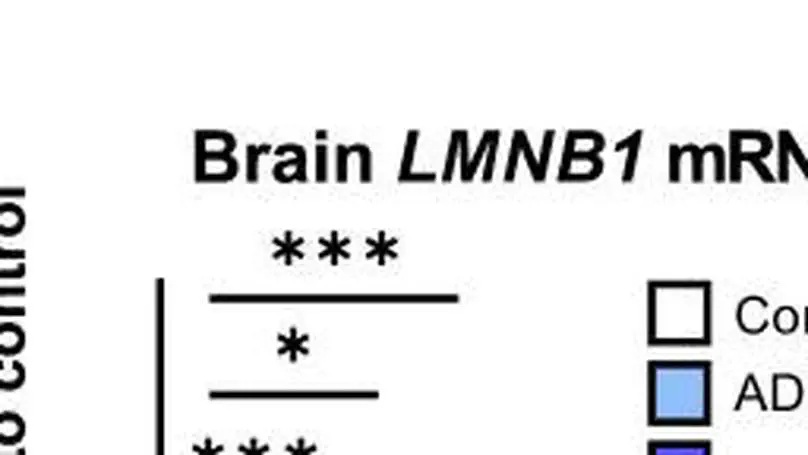 An oligodendrocyte silencer element underlies the pathogenic impact of lamin B1 structural variants
